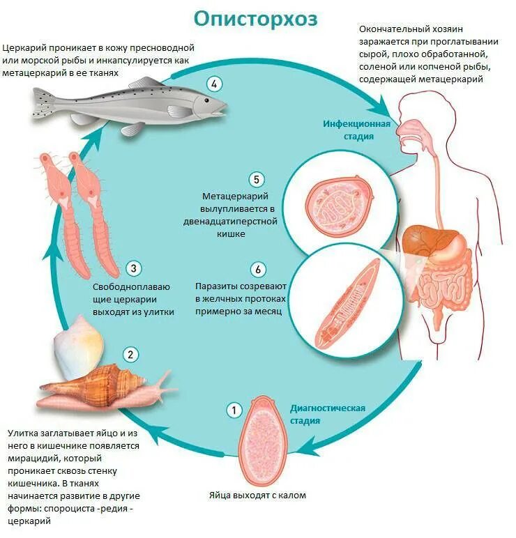 Описторхоз симптомы у взрослых. Описторхоз цикл развития паразита. цикл развития в организме человека описторх. описторх промежуточный хозяин. описторхоз это инфекционное заболевание.