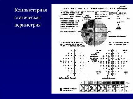 Периметрия что это такое в офтальмологии