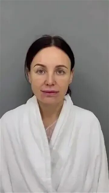 мамо пластика фото до и после. подглазничные импланты. пациентка 46 лет. беседа с пациентом. пациентка 46 лет.