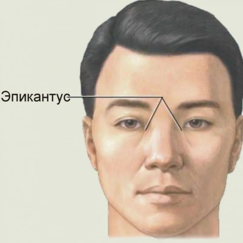 Эпикантус признак. Эпикантус монгольская складка. Эпикантус признак. Эпикантус признак. Эпикантус признак.