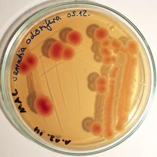 Serratia marcescens