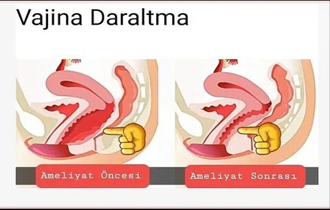 Otsiz seks partiyalari