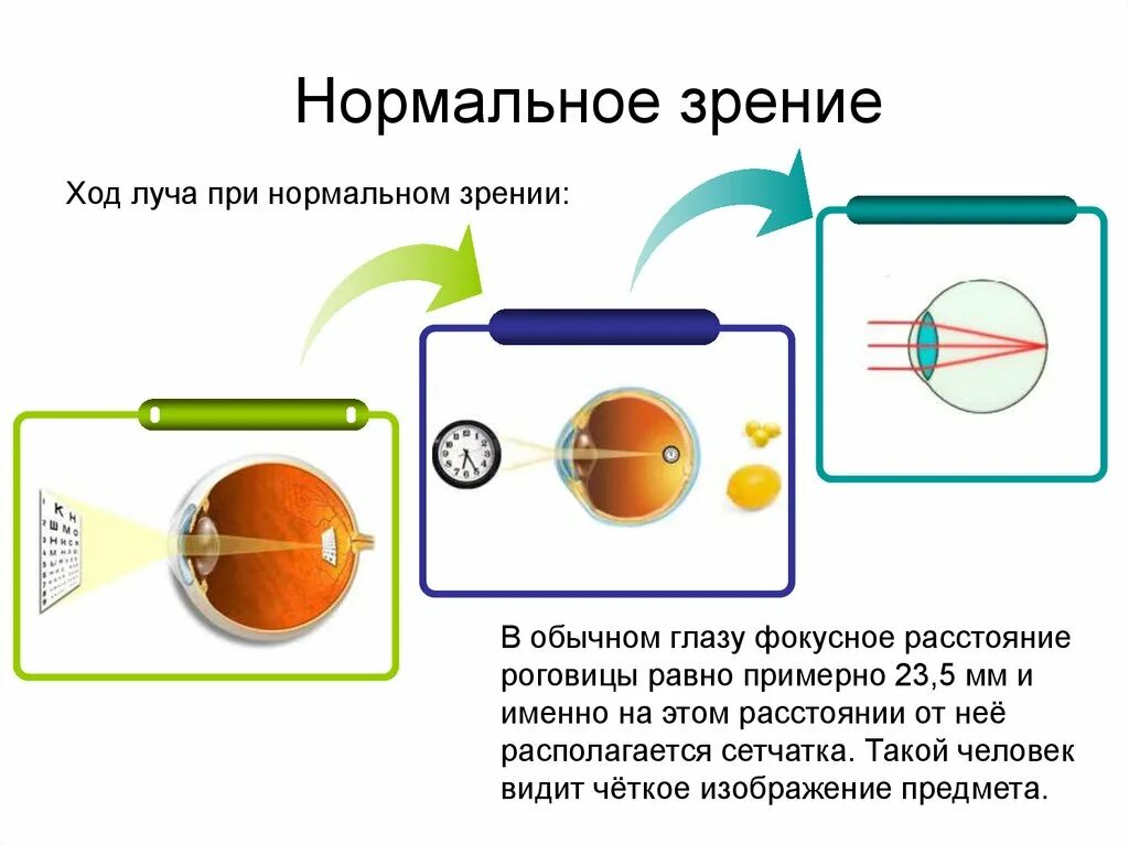 Дефекты зрения очки физика 8 класс. Глаз. Дефект зрения.. Строение глаза с точки зрения физики. Строение глаза дефекты зрения физика.