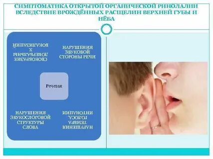 Открытая органическая ринолалия