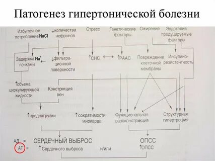 Развитие гипертонической болезни