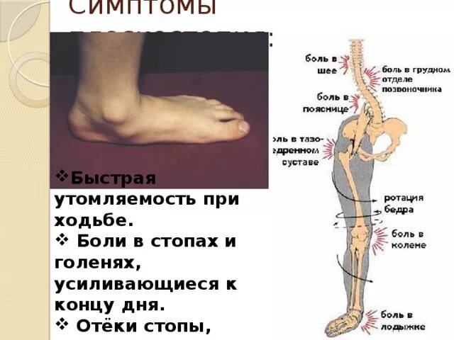 Болит щиколотка на ноге при ход.