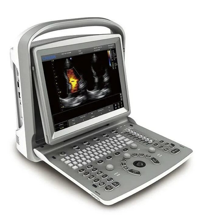 Sonotouch 50. Chison узи. Chison sonotouch. Chison sonotouch. Chison st 30.