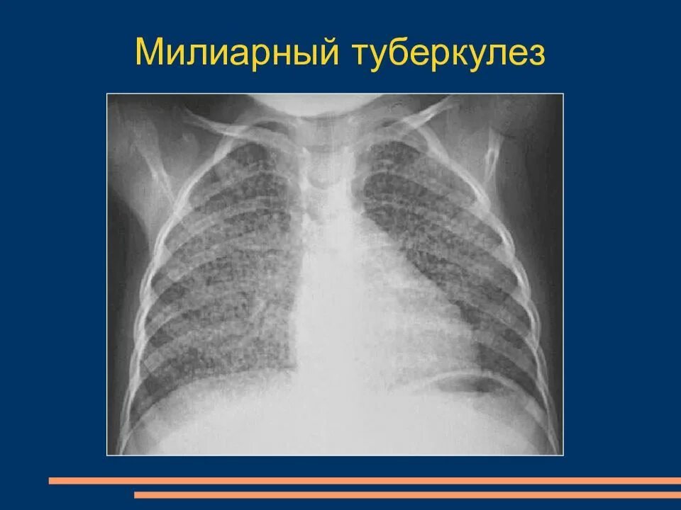 Тубик
