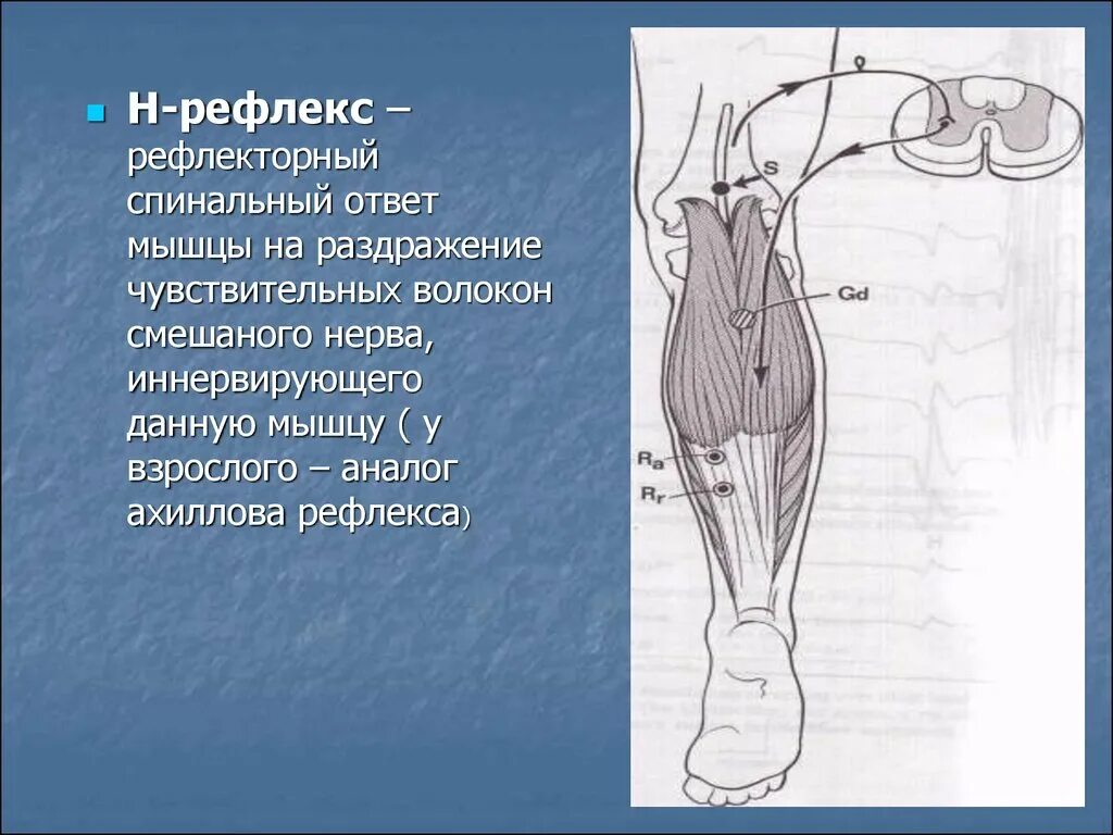 Раздражение чувствительного нерва