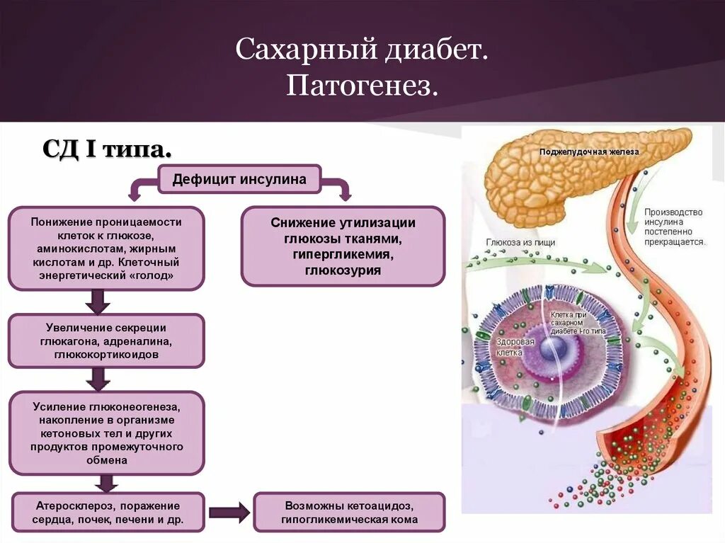 Этиология сахарного диабета 1 типа. Патогенез сахарного диабета 1 схемах. Патогенез сахарного диабета пропедевтика. Механизм формирования сахарного диабета 1 типа.