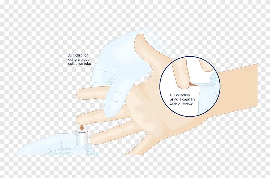 Палец колоть для анализа крови. Электронная карта в руке перчатка. Где лучше колоть палец.