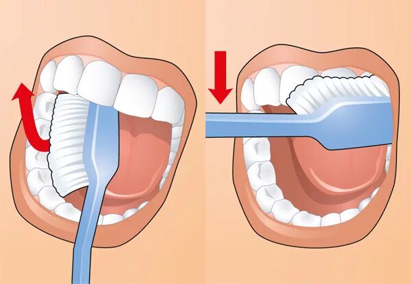 Метод басса чистка. Правильный метод чистки зубов. Классический метод чистки зубов. Движения зубной щетки при чистке зубов. Способы чистки зубов в стоматологии.