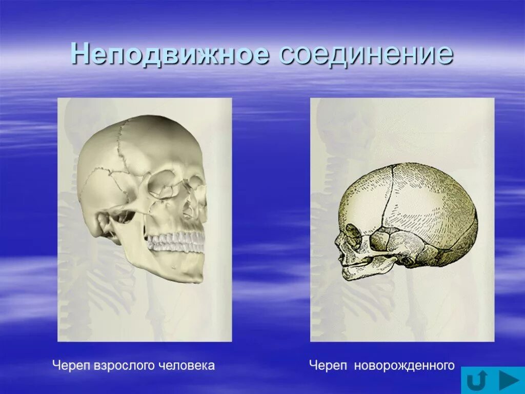 Неподвижное соединение черепа. Неподвижные кости черепа.