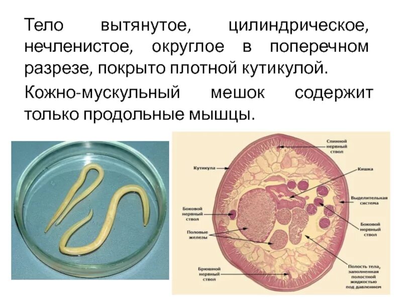 Мускульный мешок круглых червей. Кожно мускульный мешок аскариды. Кожно мускульный мешок аскариды человеческой. Поперечное сечение тела круглых червей. Кожномускульный мешок нематод.