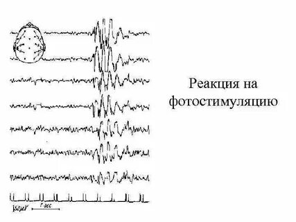Реакция усвоения