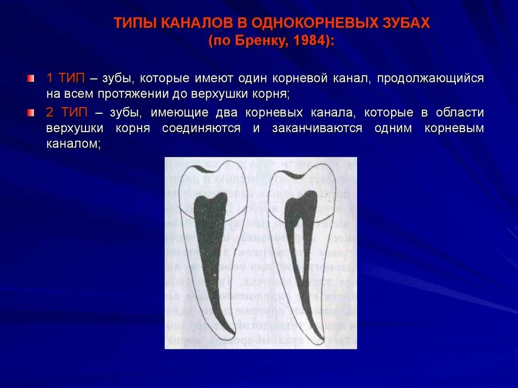 Сообщающаяся с полостью зуба. Топография полости зуба и корневых каналов. функции корневого канала зуба.