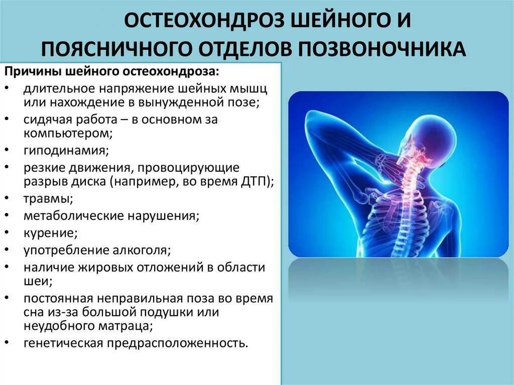 Болит хондроз что делать. Остеохондроз шейного отдела симптомы. остеохондроз шейного отдела симпто. остеохондрома шейного отдела. шейный и поясничный остеохондроз.