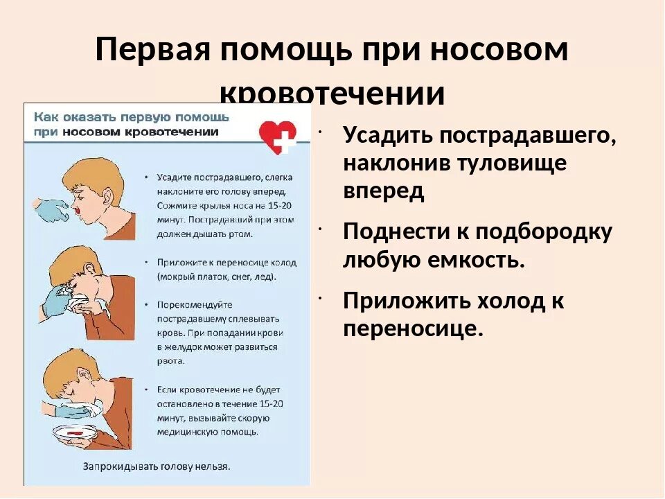 Ребенок 5 лет идет кровь из носа. Алгоритм оказание ПП при носовом кровотечении. Меры оказания первой помощи при носовом кровотечении. Оказание ПМП при носовом кровотечении. Первая помощь пострадавшему при носовом кровотечении.