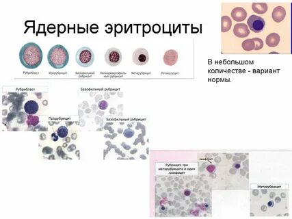 Какой уровень эритроцитов считается опасным
