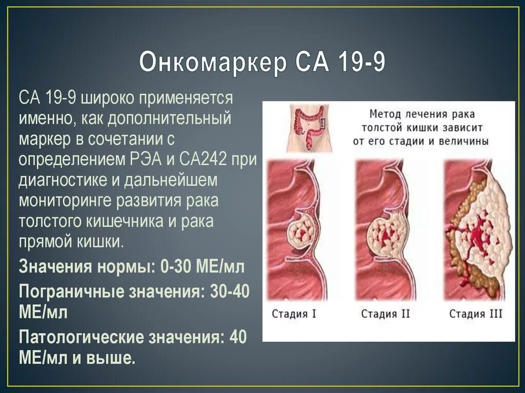 Маркеры опухоли кишечника. Онкомаркеры кишечника и прямой кишки. Са-19-9 онкомаркер. Онкомаркеры показатели.