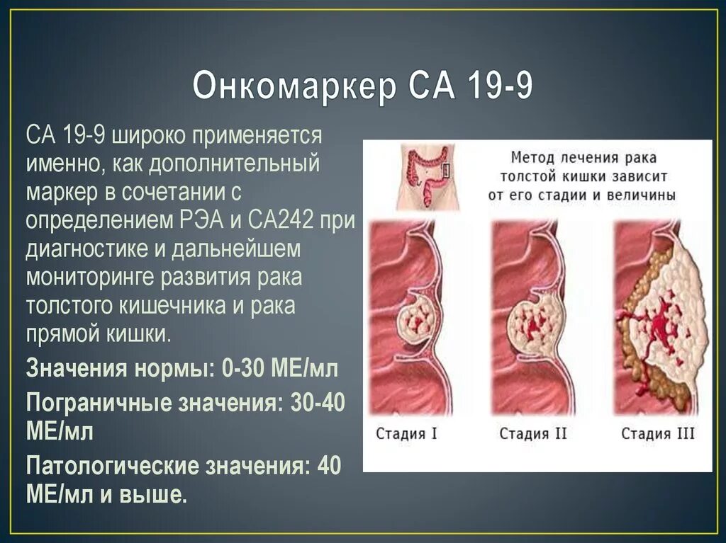 Опухолевые маркеры норма. Маркеры опухоли кишечника. Онкомаркеры кишечника и прямой кишки. Са-19-9 онкомаркер. Онкомаркеры показатели.