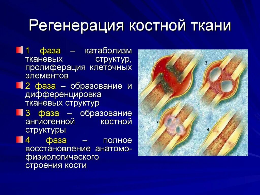 Этапы регенерации пластинчатой костной ткани. Способность к регенерации костной ткани. Укажите этапы регенерации костной ткани после повреждения.. Репаративная регенерация тканей.