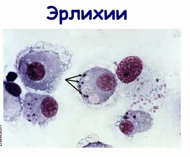 Моноцитарный эрлихиоз человека что это. Моноцитарный эрлихиоз. моноцитарный эрлихиоз собак. моноцитарный эрлихиоз человека возбудитель. эрлихиоз собак микробиология.