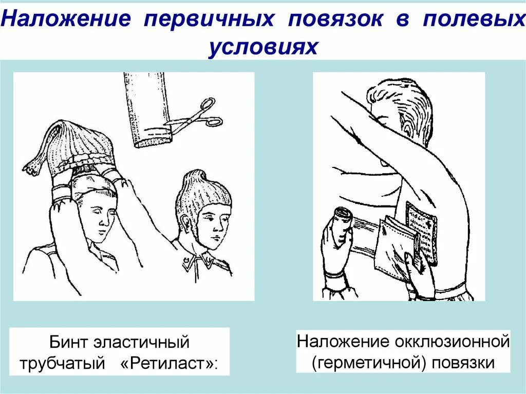 Способы наложения повязок при кровотечении. Наложение первичной повязки. Наложение первичных повязок в полевых условиях. Наложение окклюзионной повязки.