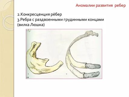 Ребро люшке