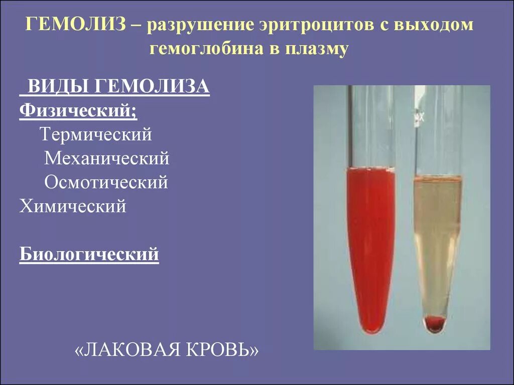 Признак гемолизированной крови плазма. Гемолиз эритроцитов в пробирке. Причины осмотического гемолиза эритроцитов.