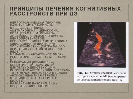 Когнитивные расстройства препараты