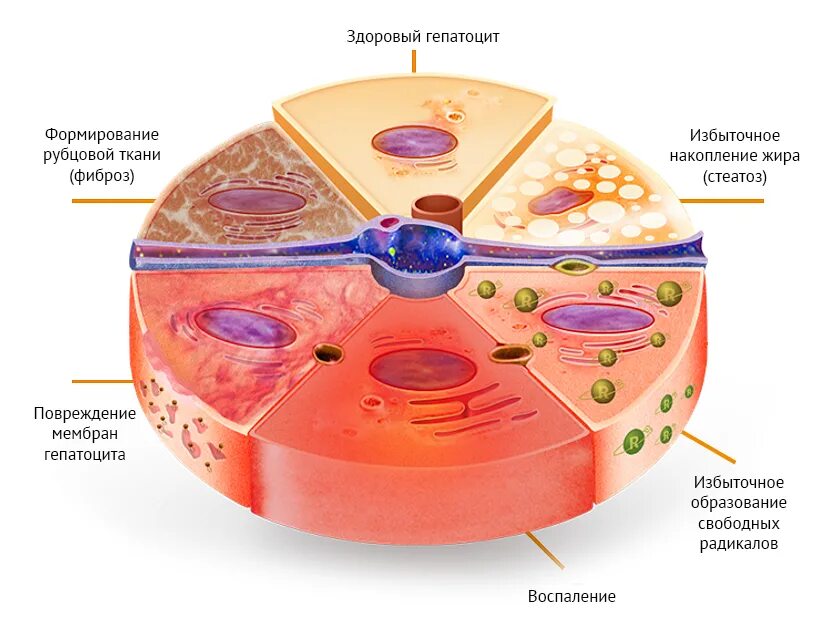 Гепатоцит и печеночная долька. Клетка печени гепатоцит. Клеточная структура печени. Строение клетка печени гепатоцит. Патологическое пространство