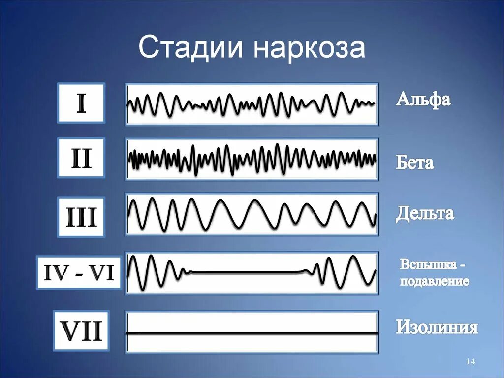 Степени наркоза. Стадии наркоза. этапы анестезии. стадии общих анестетиков. наркоз стадии наркоза.