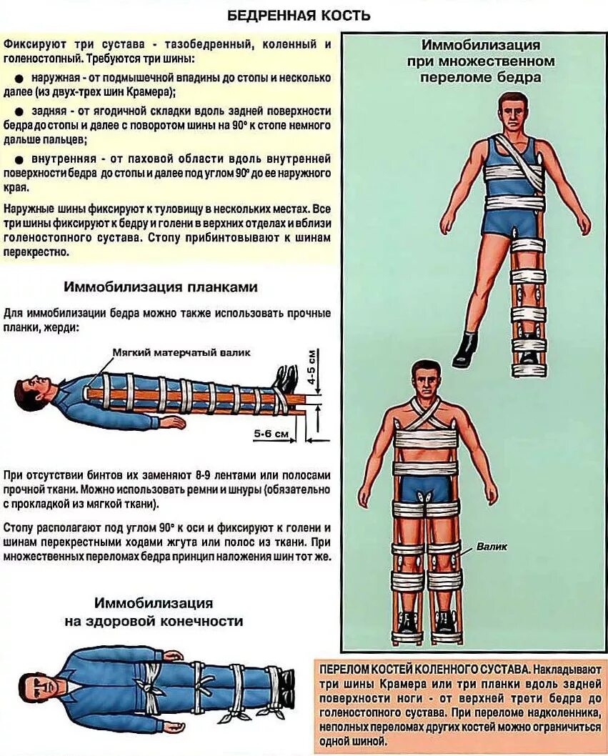 Способы и особенности фиксации конечностей. Транспортная иммобилизация при переломе бедренной кости алгоритм. Протяженность иммобилизации при пере. При переломе бедренной кости шина накладывается от. Транспортная иммобилизация при переломе бедра алгоритм.