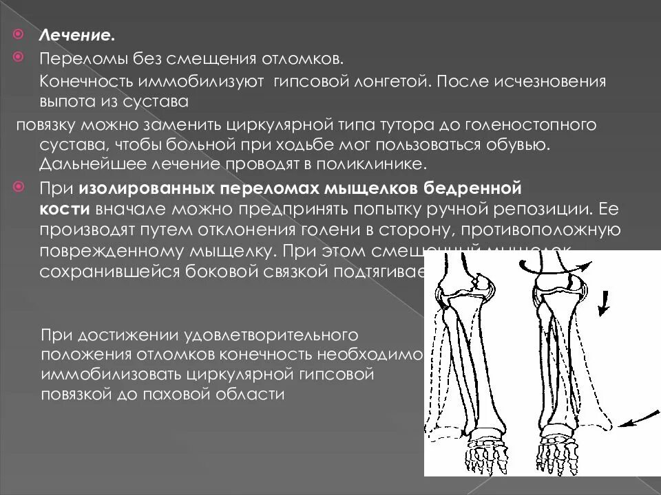 Прогнозы после операции перелома шейки. Открытый перелом диафиза бедренной кости. Бедренная кость перелом диафиза. Перелом диафиза бедренной кости. Перелом диафиза бедренной кости смещение отломков.