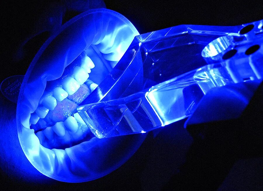 Ультрафиолетовое излучение люминесценция. Ультрафиолетовая лампа для зубов. Ультрафиолетовая лампа для отбеливания зубов. Ультрафиолетовое свечение.