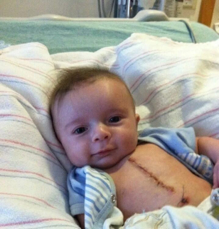 как детям делают операцию. после операции ребенка. ребенок в больнице реанимации. девочка после операции. после операции ребенка.