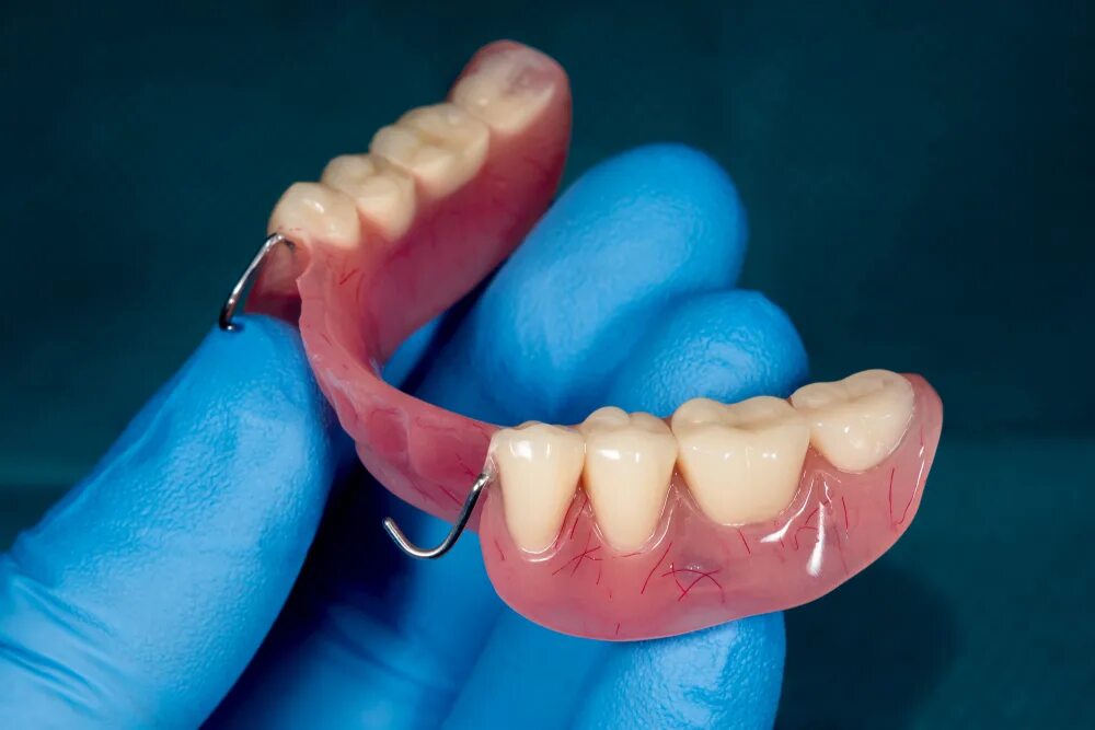 Снимать ли зубные протезы на ночь. Эстетический протез для зубов. Зубные протезы дискомфорт.