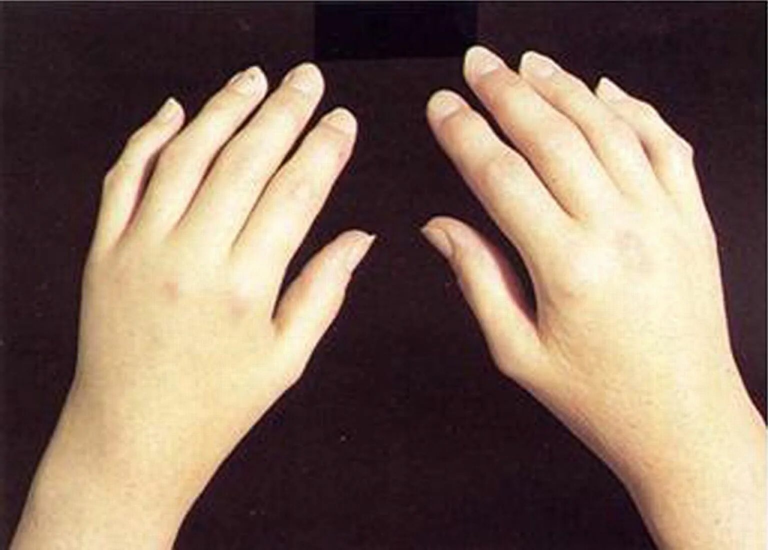 Правая рука молодой девушки. Рука ладонь. Юные пальцы. Юные пальцы. Детская рука.