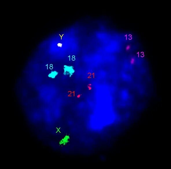 Днк зонд. Молекулярная цитогенетика. Метод ДНК зондов. Interphase-Fish.