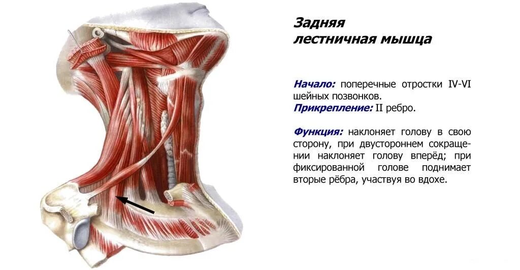 Лестничные мышцы анатомия. Передняя лестничная мышца анатомия. Лестничные мышцы шеи анатомия. Передняя лестничная мышца шеи анатомия. Синдром лестничных мышц шеи.