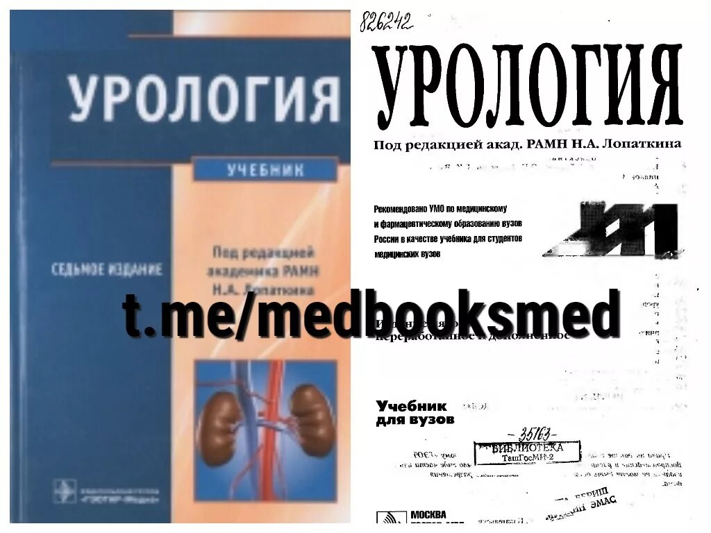 Урология ответы. Учебник по урологии. Пособие по урологии. Урология учебник Лопаткин. Книги по урологии.