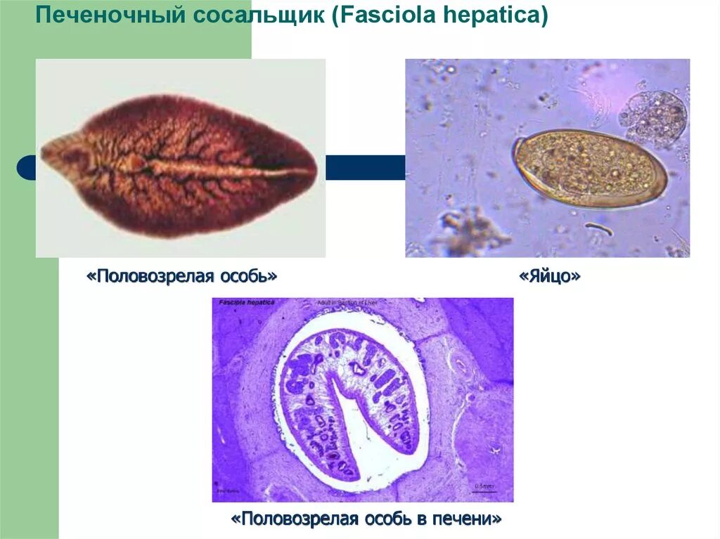 Fasciola hepatica яйца. Марита Fasciola hepatica строение. Марита трематоды. Фасциола гепатика личинка. Печеночный сосальщик диагностика