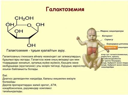 Фруктоземия