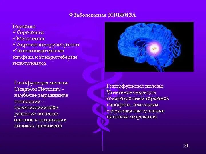 Патологии гормонов эпифиза. Эпифиз нарушение функции болезни. Эпифиз гормон функции патология. Эпифиз гормоны и заболевания. Гипофункция мелатонина гормона