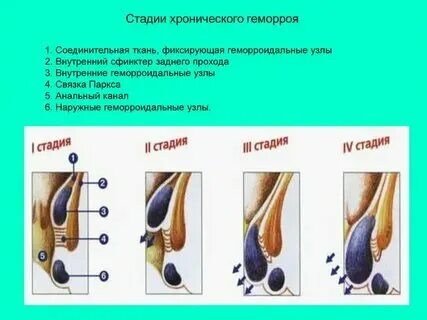 Зуб в заднем проходе. Зуб в заднем проходе
