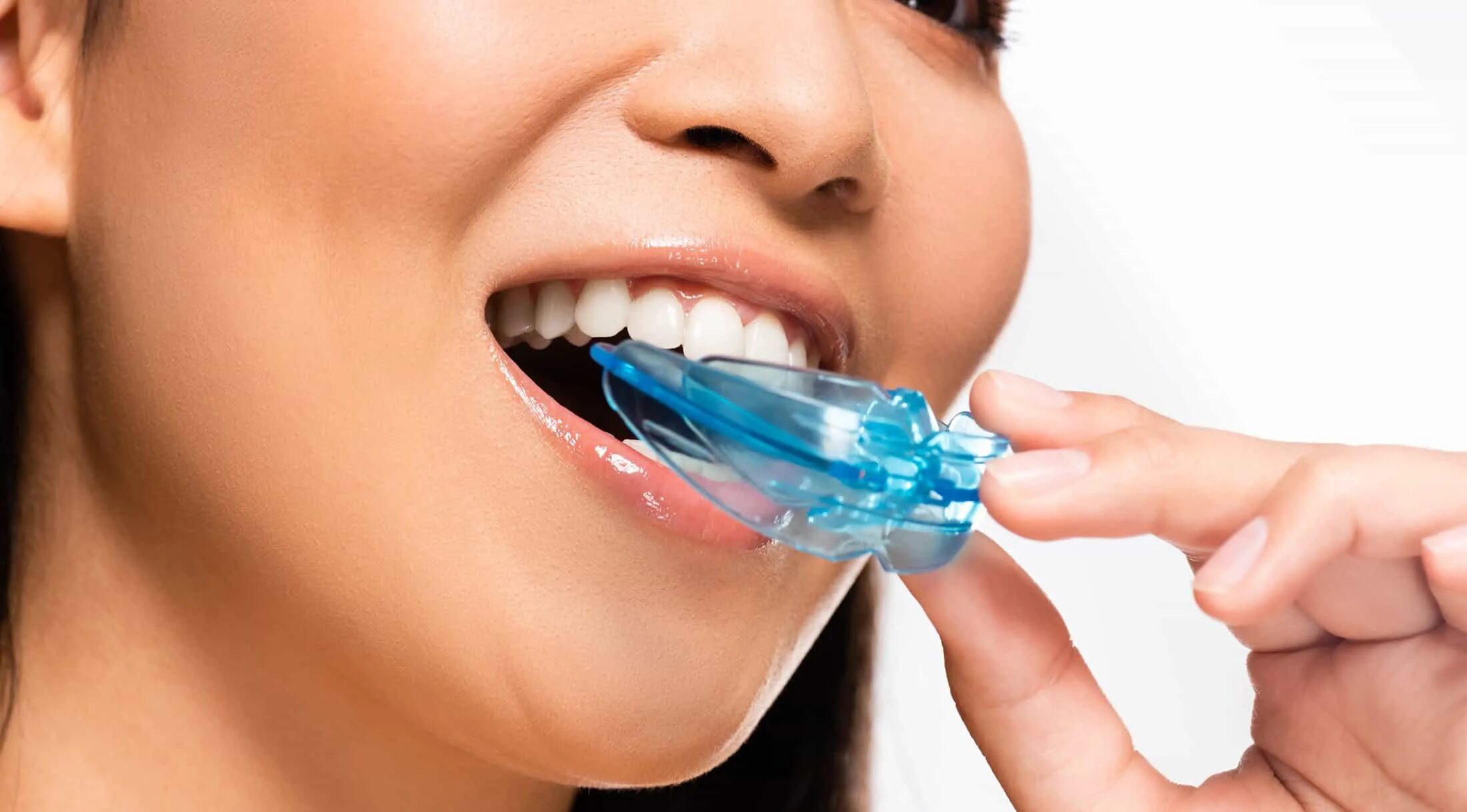 Кап рта. Каппы (стоматология). Капа для зубов во рту. Каппа для аппликаций на зубы.