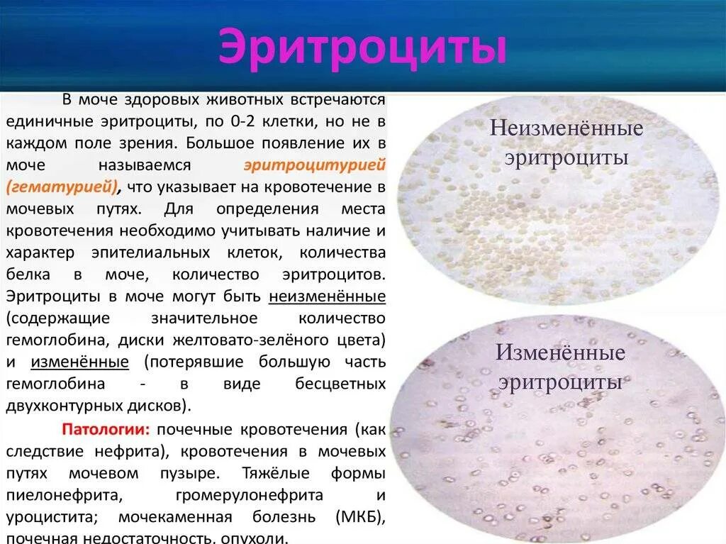 Повышенные эритроциты почки. Измененные эритроциты в моче 1-3. эритроциты в моче микроскопия. измененные (дисморфные) эритроциты в моче. неизмененные эритроциты в моче.