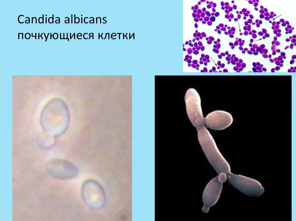 Candida альбиканс. Дрожжевые грибы кандида.