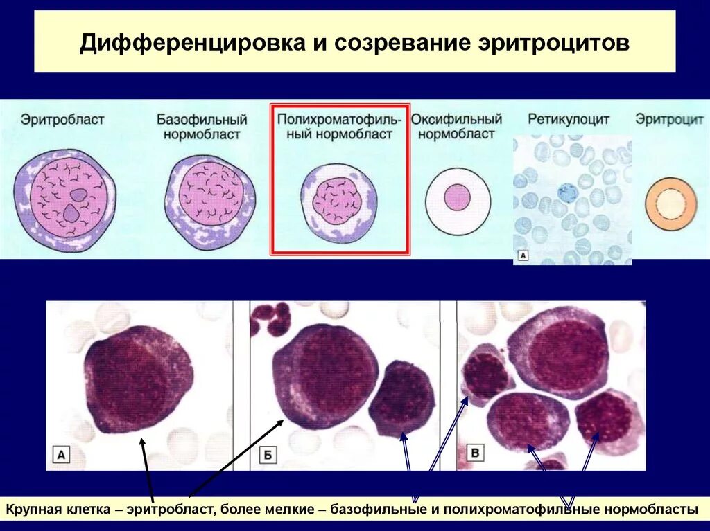 Зрелость клеток. Стадии дифференцировки эритроцитов. Оксифильный эритробласт. Нормобласты и мегалобласты. Нормобласт клетка.